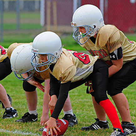 mouthguards